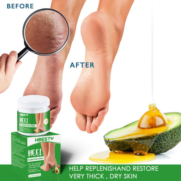 Avocado Heel Cracking Cream - Image 4